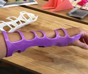 Washable Hand Splint 3D Models